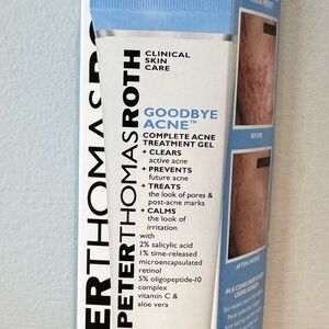 Peter Thomas Roth Goodbye Acne Treatment Gel - Blue and White